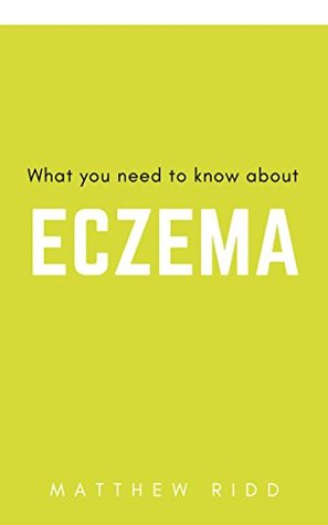 Full Download ATOPIC ECZEMA: What you need to know about it - Matthew Ridd file in PDF